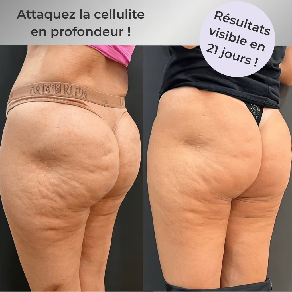 SculptEase 2.0™ Votre Rituel Beauté & Bien Être Complet