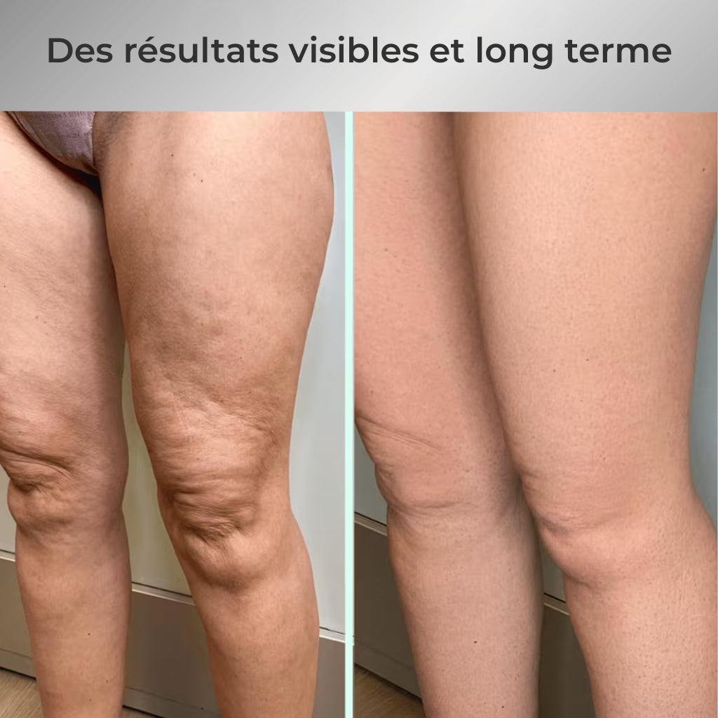 SculptEase 2.0™ Votre Rituel Beauté & Bien Être Complet
